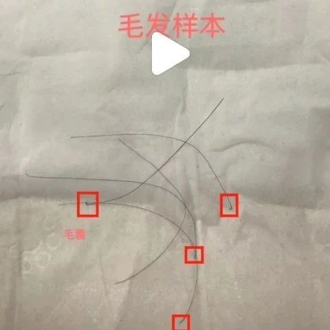 沈阳个人隐私亲子鉴定，拔下来的头发才能做鉴定哦！2023最新