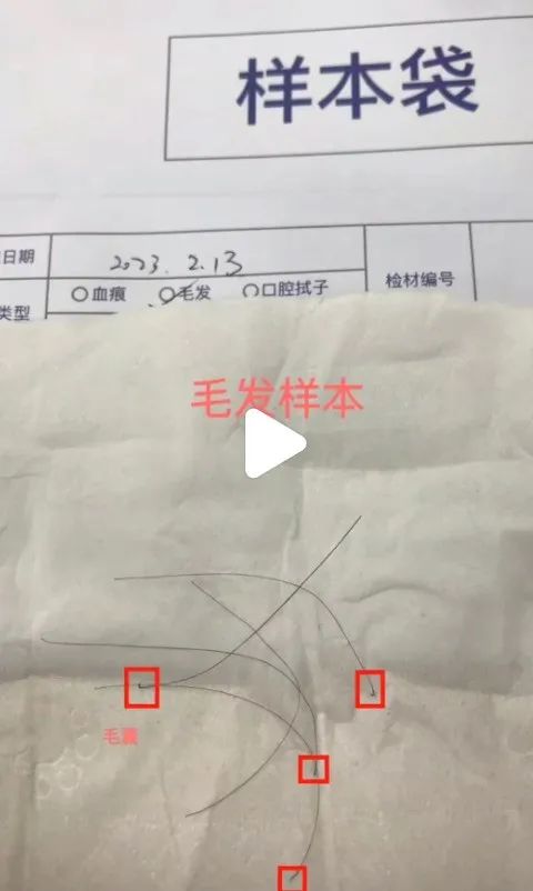沈阳个人隐私亲子鉴定，拔下来的头发才能做鉴定哦！2023最新插图1