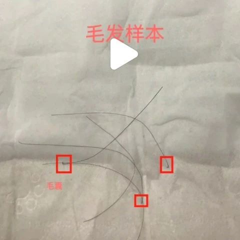 拔下来的头发可以做亲子鉴定，可以邮寄到沈阳亲子鉴定中心