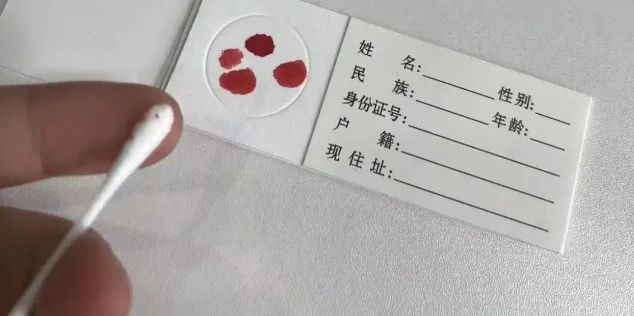 沈阳亲子鉴定需要怎样采样，可以不到现场办理？结果准确？插图2