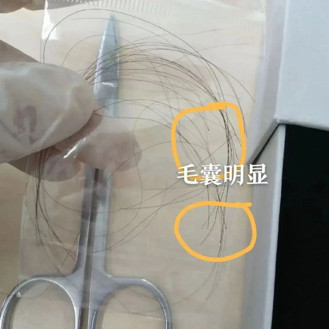 沈阳泰子基因鉴定机构，还有哪些基因检测服务适合在家完成？