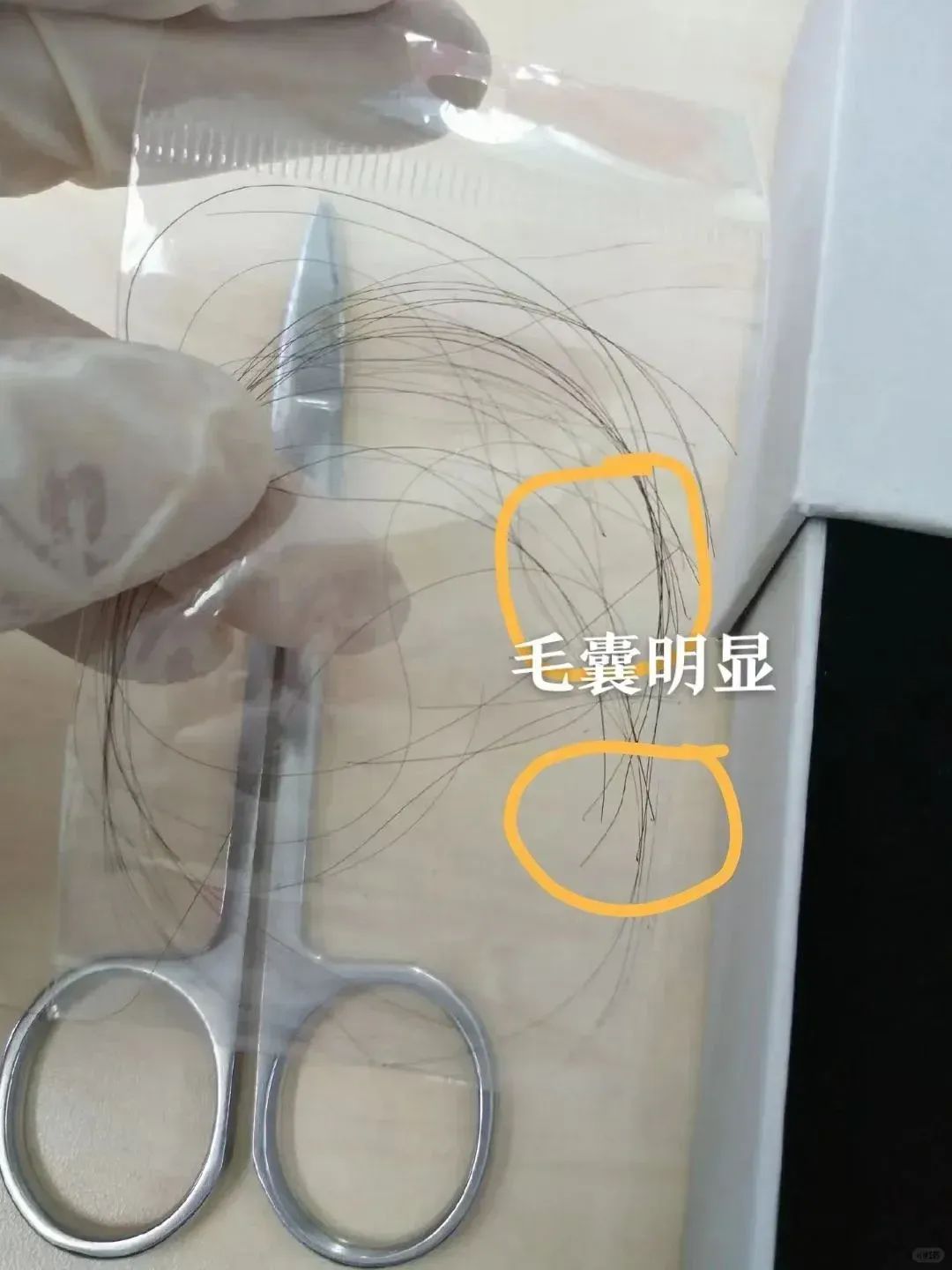 沈阳泰子基因隐私亲子关系认定，拔下来的头发可以做亲子鉴定？插图2