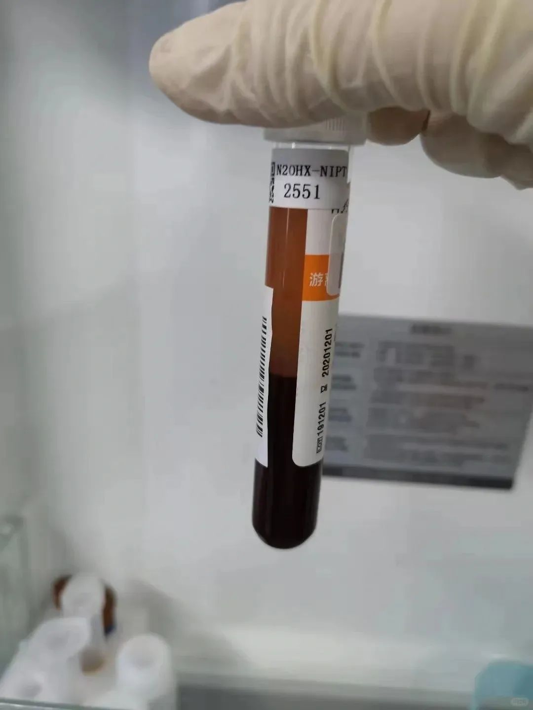 天津孕期亲子关系鉴定费用多少钱，需要怎样采样，多久出结果插图