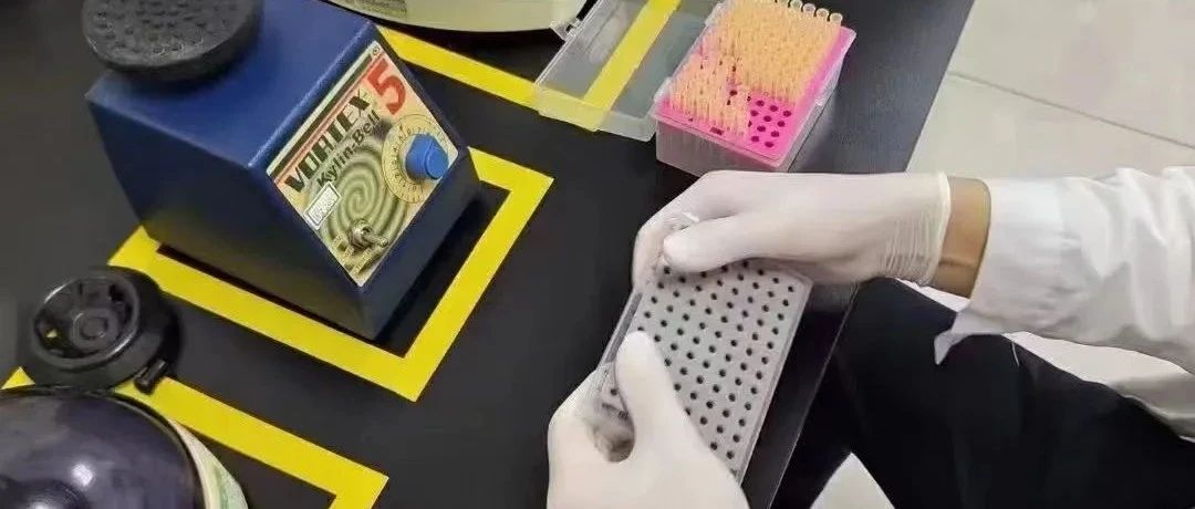苏州亲子鉴定：拔下来的头发可以做 DNA 检测？结果出来要多长时间？