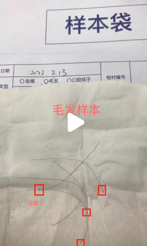 苏州邮寄头发样本DNA鉴定更实惠？检测结果可以当天出？插图1