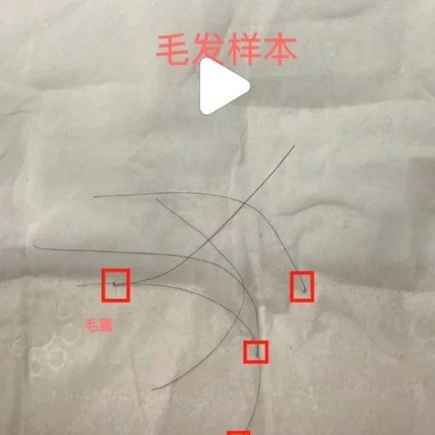 拔下来的头发也能做DNA鉴定？上海亲子鉴定中心邮寄地址是？