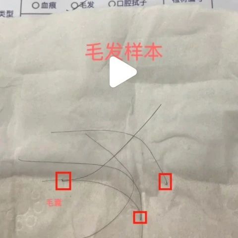 苏州邮寄头发样本DNA鉴定更实惠？检测结果可以当天出？