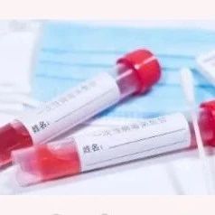 上海无创亲子鉴定孕妇怀孕期间也能做，不需要手术，安全便捷