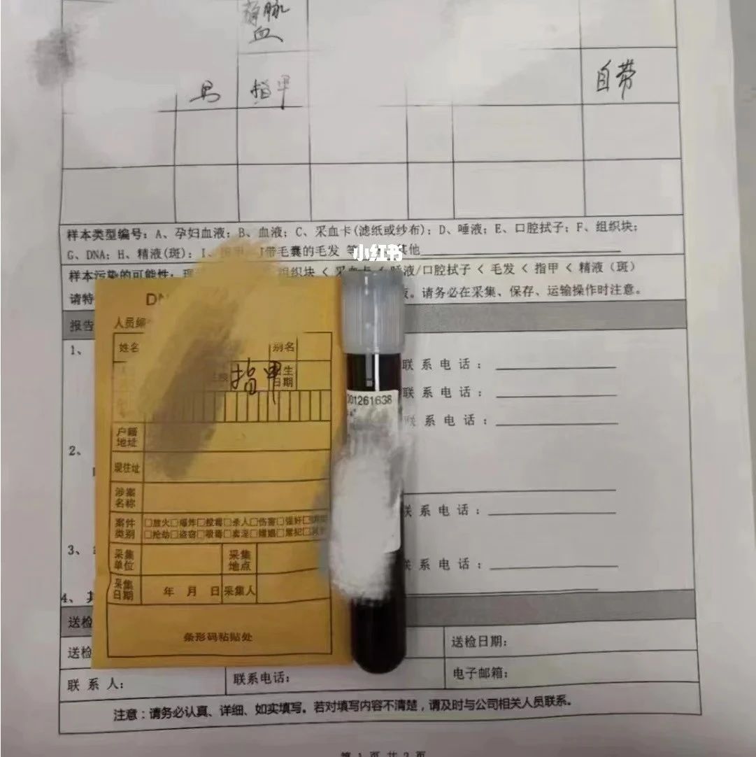上海怀孕无创胎儿亲子关系鉴定，孕妇医院采样，安全且结果准确