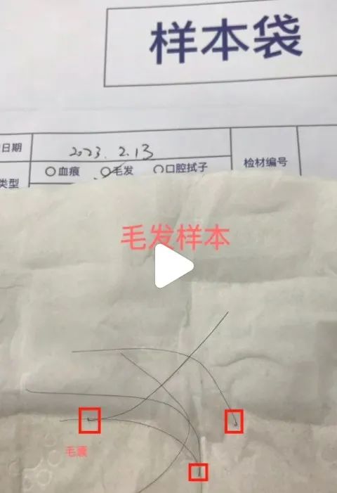 天津亲子关系确认中心，测头发DNA即可知道是否存在亲生关系插图2