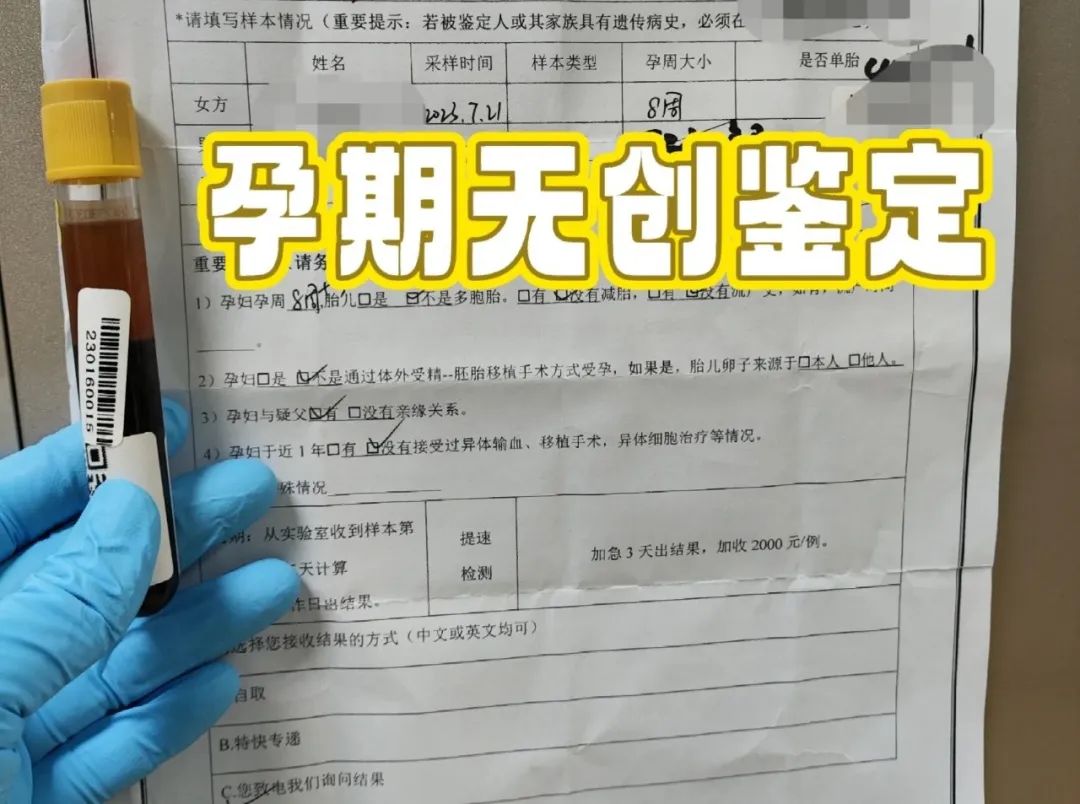 苏州孕期胎儿亲生关系认定，男方可以不用到现场，采集头发样本插图1