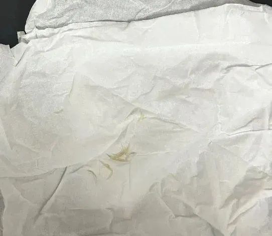 天津隐私亲子鉴定除了送检头发，还有哪些样本可以用于亲子鉴定？插图2
