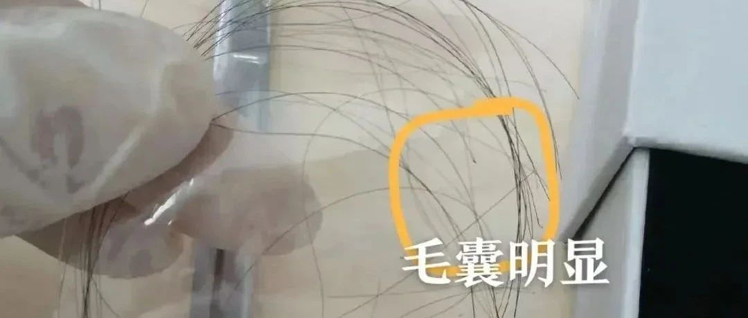 苏州隐私亲生关系认证，拔下来的头发通过邮寄也能检测DNA