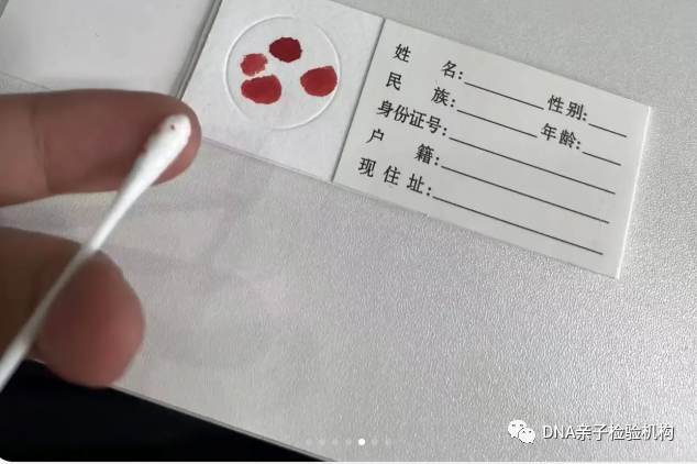 天津小孩打预防针棉签血液可以做亲子鉴定，通过邮寄即可检测插图