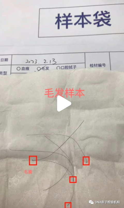 毛发苏州亲子鉴定要多少钱的费用，小孩读书不方便可以在家采样？插图2