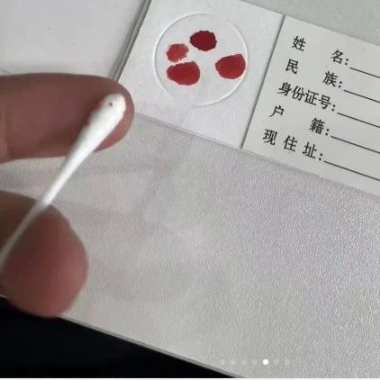 天津小孩打预防针棉签血液可以做亲子鉴定，通过邮寄即可检测