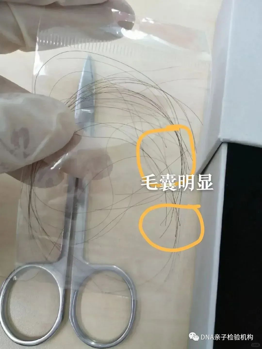 苏州隐私亲生关系认证，拔下来的头发通过邮寄也能检测DNA插图1