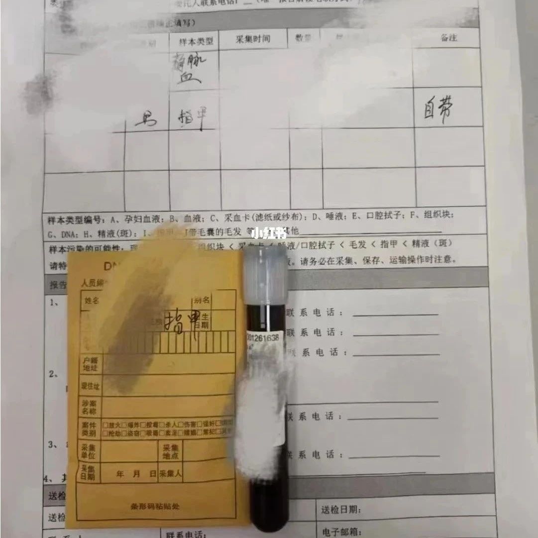 天津无创胎儿亲子鉴定是如何采集孕妇的静脉血样本的？要到现场？
