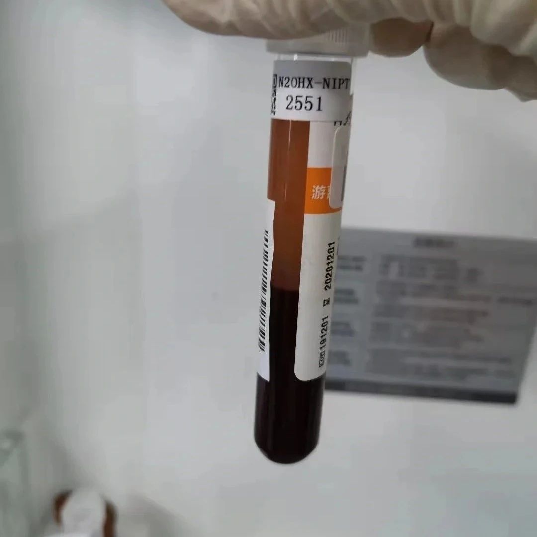 天津孕期亲子关系鉴定费用多少钱，需要怎样采样，多久出结果
